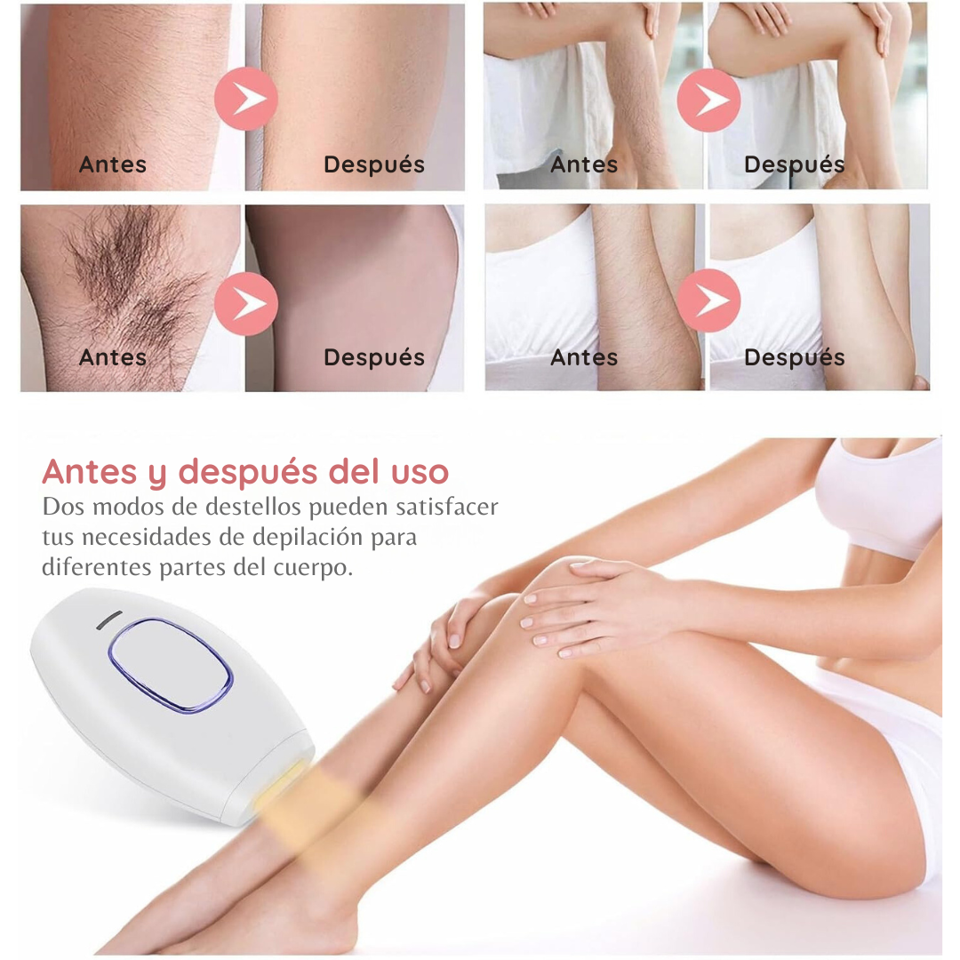 Depiladora Laser